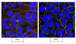 MilliporeSigma anti-CD46 Clone: 8A9.1, 100&mu;g, Unlabeled:Antibodies,